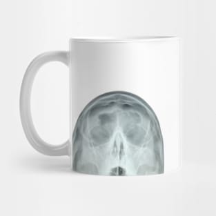 my head x-ray Mug